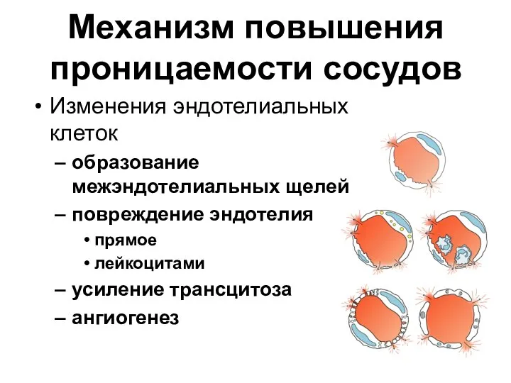 Механизм повышения проницаемости сосудов Изменения эндотелиальных клеток образование межэндотелиальных щелей повреждение