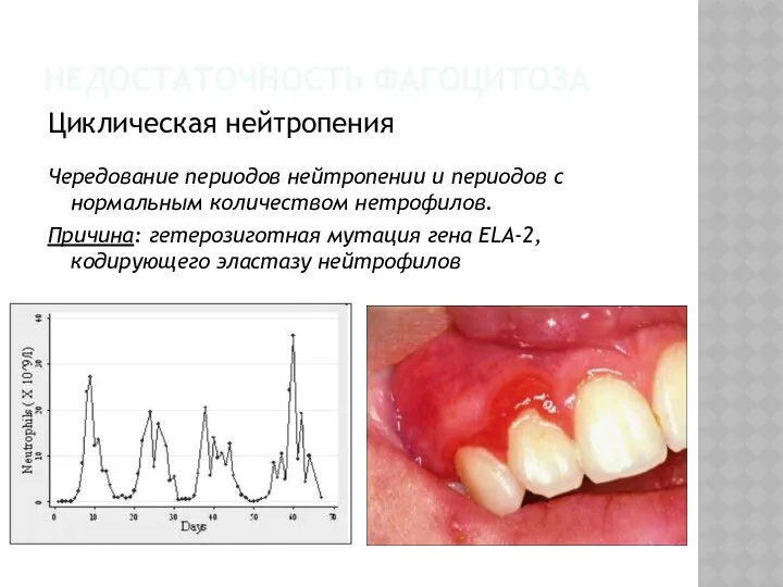 Циклическая нейтропения Чередование периодов нейтропении и периодов с нормальным количеством нетрофилов.