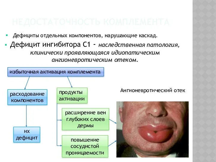 НЕДОСТАТОЧНОСТЬ КОМПЛЕМЕНТА Дефицит ингибитора С1 - наследственная патология, клинически проявляющаяся идиопатическим