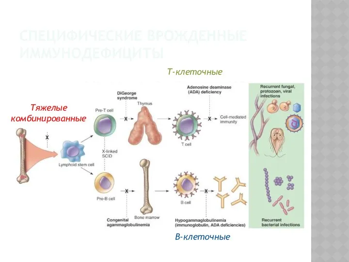 СПЕЦИФИЧЕСКИЕ ВРОЖДЕННЫЕ ИММУНОДЕФИЦИТЫ Т-клеточные В-клеточные Тяжелые комбинированные