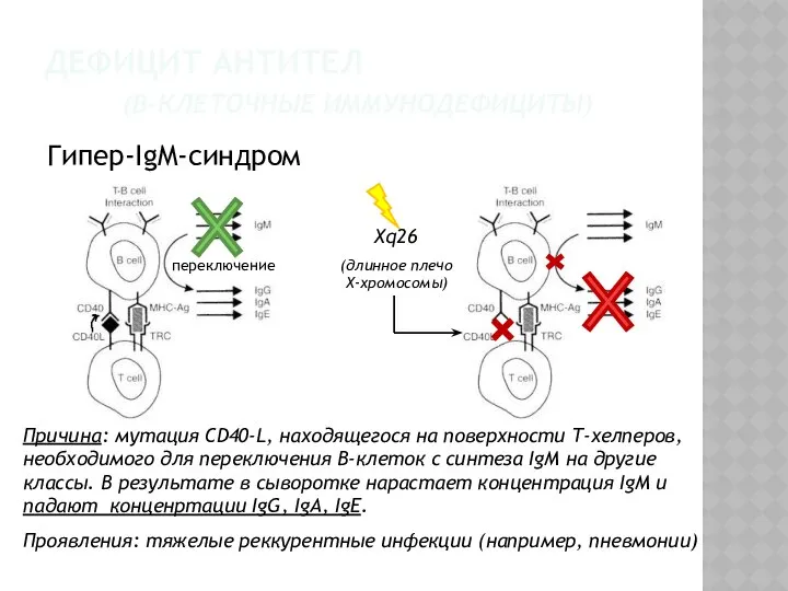 Гипер-IgM-синдром ДЕФИЦИТ АНТИТЕЛ (В-КЛЕТОЧНЫЕ ИММУНОДЕФИЦИТЫ) переключение Причина: мутация СD40-L, находящегося на