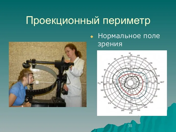 Проекционный периметр Нормальное поле зрения