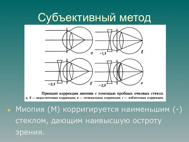 Субъективный метод Миопия (М) корригируется наименьшим (-) стеклом, дающим наивысшую остроту зрения.