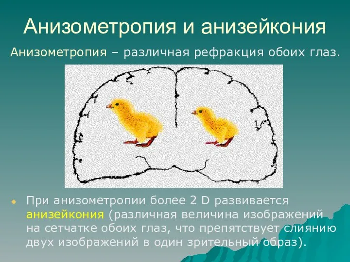 Анизометропия и анизейкония При анизометропии более 2 D развивается анизейкония (различная