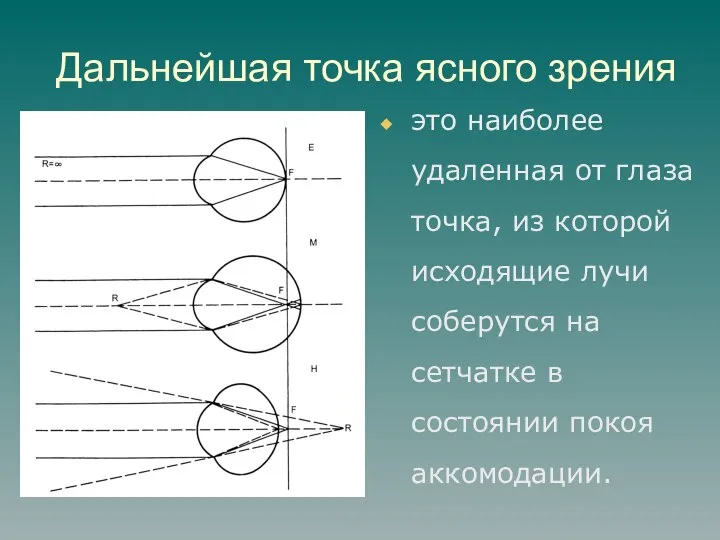 Дальнейшая точка ясного зрения это наиболее удаленная от глаза точка, из