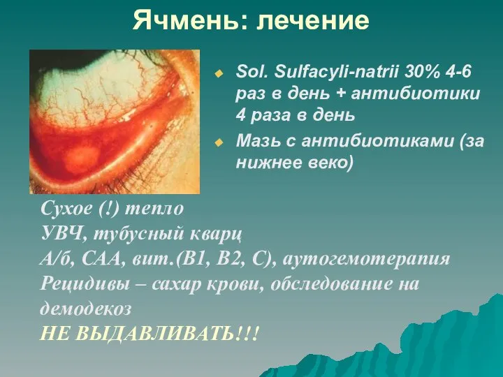 Ячмень: лечение Sol. Sulfacyli-natrii 30% 4-6 раз в день + антибиотики