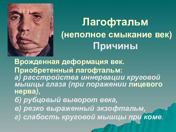 Лагофтальм (неполное смыкание век) Причины Врожденная деформация век. Приобретенный лагофтальм: а)