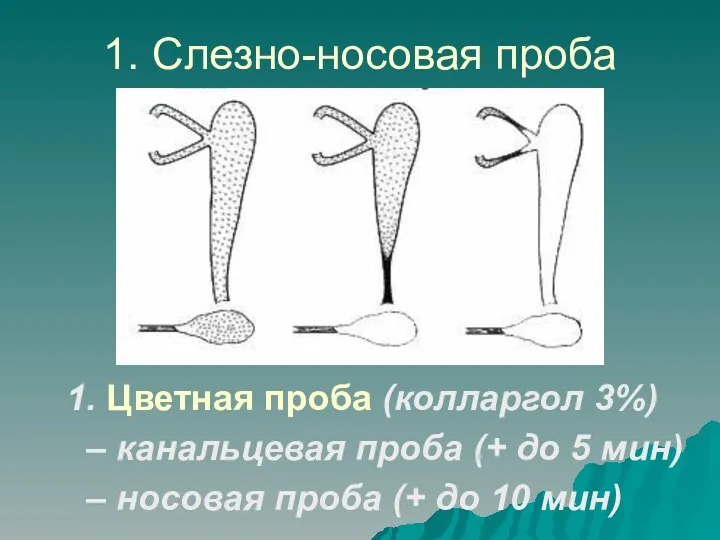 1. Слезно-носовая проба 1. Цветная проба (колларгол 3%) – канальцевая проба