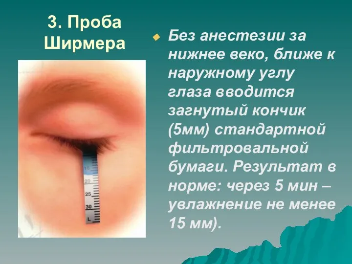 3. Проба Ширмера Без анестезии за нижнее веко, ближе к наружному