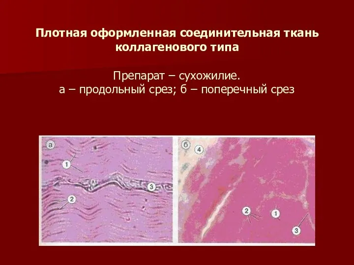 Плотная оформленная соединительная ткань коллагенового типа Препарат – сухожилие. а –