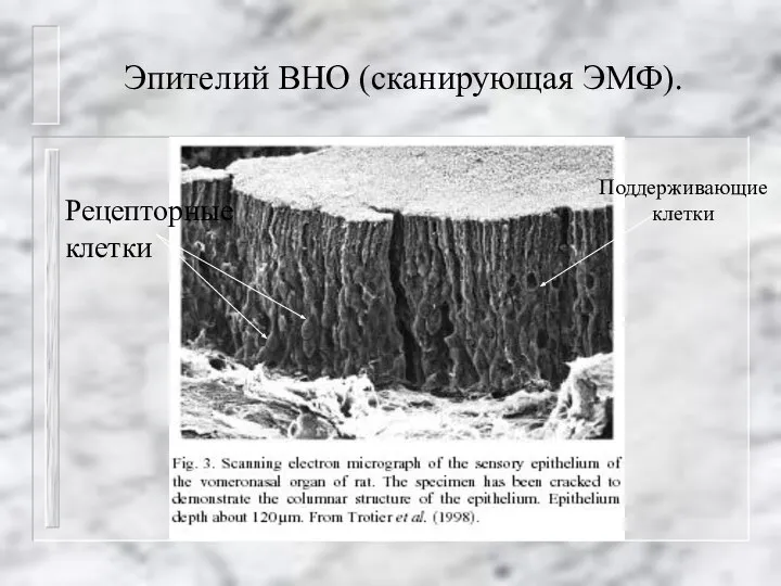 Эпителий ВНО (сканирующая ЭМФ). Рецепторные клетки Поддерживающие клетки