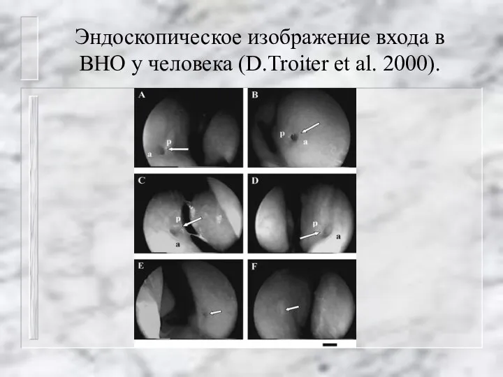 Эндоскопическое изображение входа в ВНО у человека (D.Troiter et al. 2000).