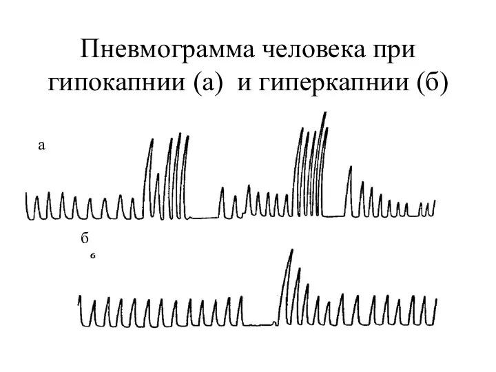 Пневмограмма человека при гипокапнии (а) и гиперкапнии (б) а б