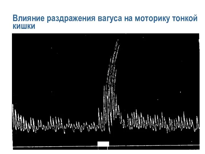 Влияние раздражения вагуса на моторику тонкой кишки