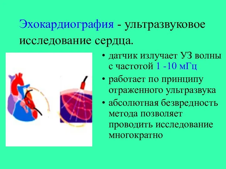 Эхокардиография - ультразвуковое исследование сердца. датчик излучает УЗ волны с частотой