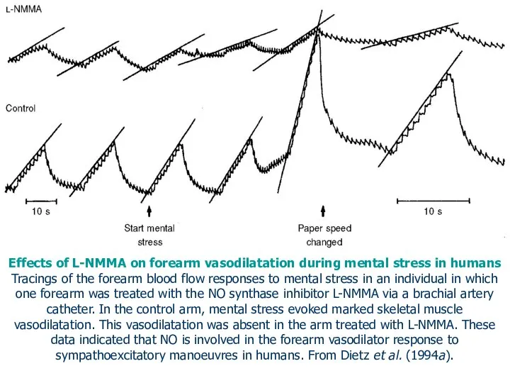 Effects of L-NMMA on forearm vasodilatation during mental stress in humans