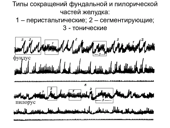 Типы сокращений фундальной и пилорической частей желудка: 1 – перистальтические; 2