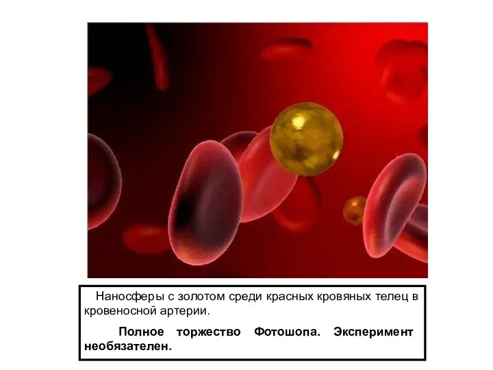 Наносферы с золотом среди красных кровяных телец в кровеносной артерии. Полное торжество Фотошопа. Эксперимент необязателен.
