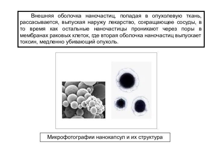 Внешняя оболочка наночастиц, попадая в опухолевую ткань, рассасывается, выпуская наружу лекарство,