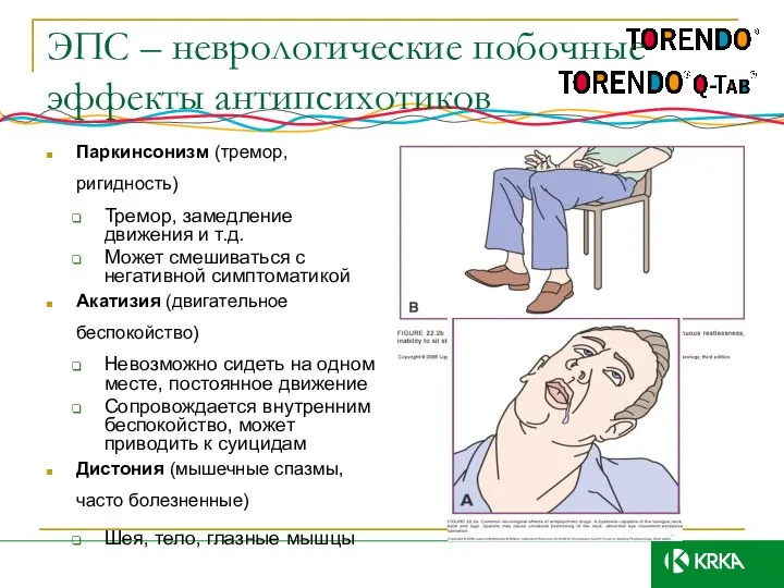 ЭПС – неврологические побочные эффекты антипсихотиков Паркинсонизм (тремор, ригидность) Тремор, замедление