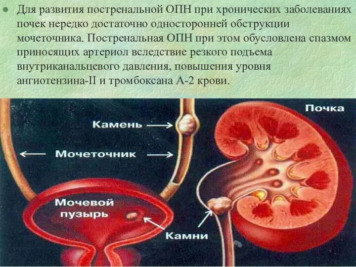 Для развития постренальной ОПН при хронических заболеваниях почек нередко достаточно односторонней