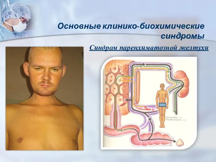 Основные клинико-биохимические синдромы Синдром паренхиматозной желтухи