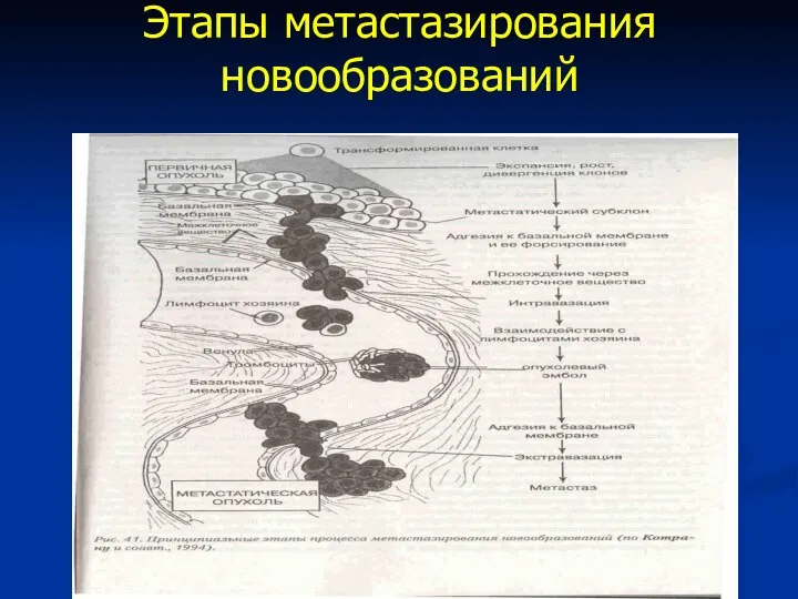 Этапы метастазирования новообразований