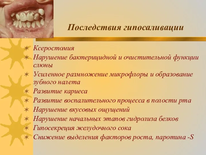 Последствия гипосаливации Ксеростомия Нарушение бактерицидной и очистительной функции слюны Усиленное размножение