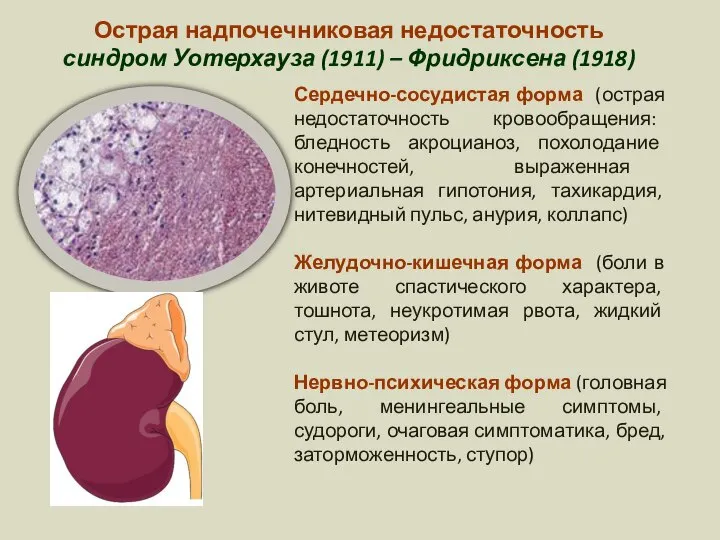 Острая надпочечниковая недостаточность синдром Уотерхауза (1911) – Фридриксена (1918) Сердечно-сосудистая форма