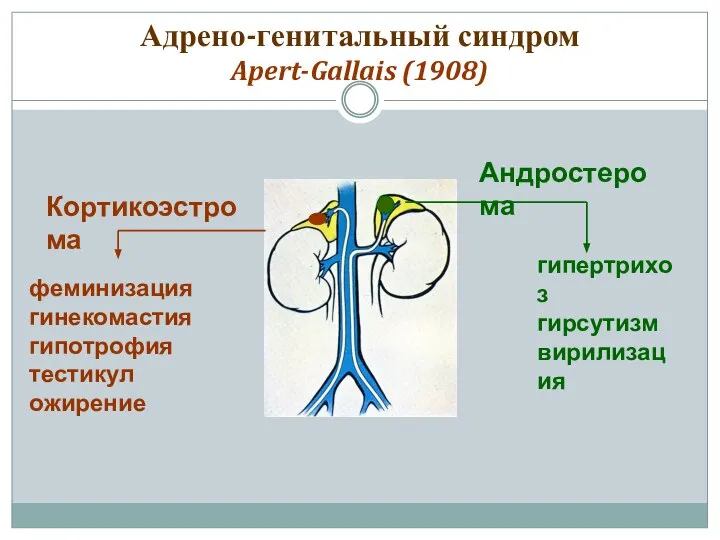 Адрено-генитальный синдром Apert-Gallais (1908) Андростерома Кортикоэстрома феминизация гинекомастия гипотрофия тестикул ожирение гипертрихоз гирсутизм вирилизация