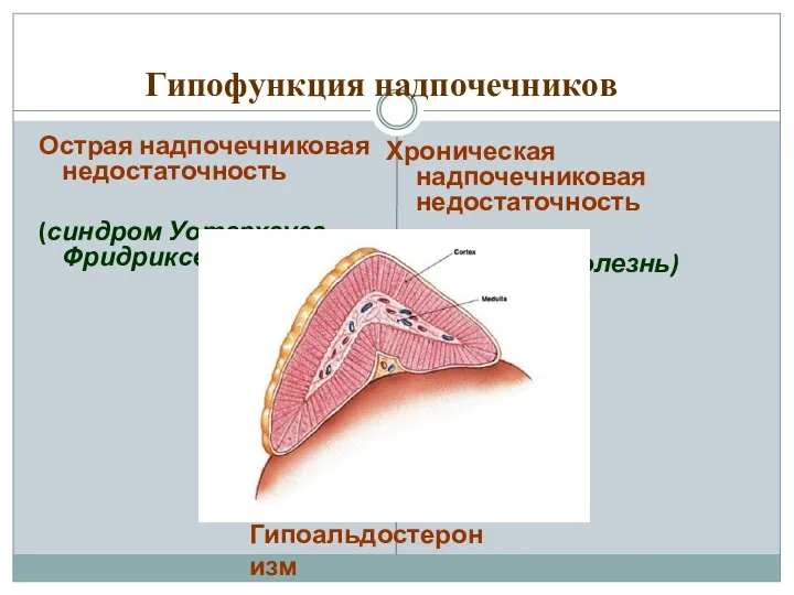 Гипофункция надпочечников Острая надпочечниковая недостаточность (синдром Уотерхауза – Фридриксена) Хроническая надпочечниковая недостаточность (Аддисонова болезнь) Гипоальдостеронизм