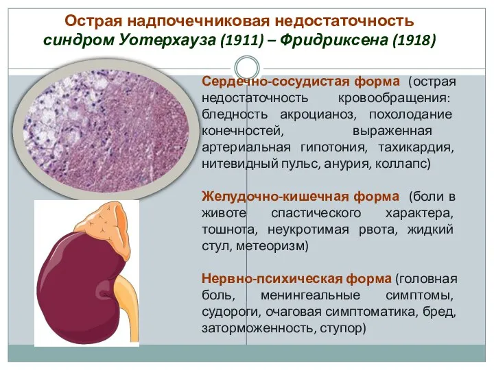 Острая надпочечниковая недостаточность синдром Уотерхауза (1911) – Фридриксена (1918) Сердечно-сосудистая форма