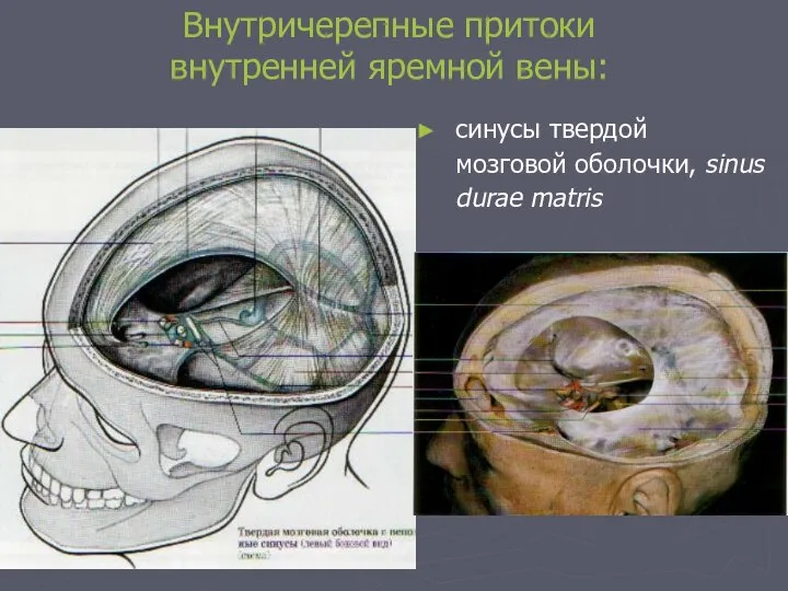 Внутричерепные притоки внутренней яремной вены: cинусы твердой мозговой оболочки, sinus durae matris