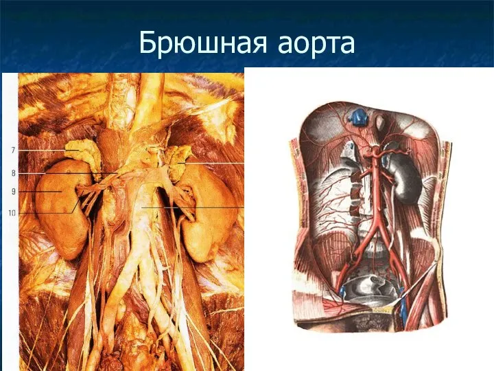 Брюшная аорта