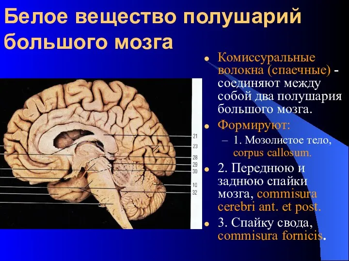 Белое вещество полушарий большого мозга Комиссуральные волокна (спаечные) - соединяют между