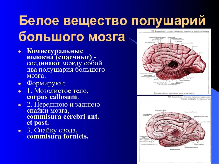 Белое вещество полушарий большого мозга Комиссуральные волокна (спаечные) - соединяют между