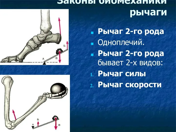 Законы биомеханики рычаги Рычаг 2-го рода Одноплечий. Рычаг 2-го рода бывает