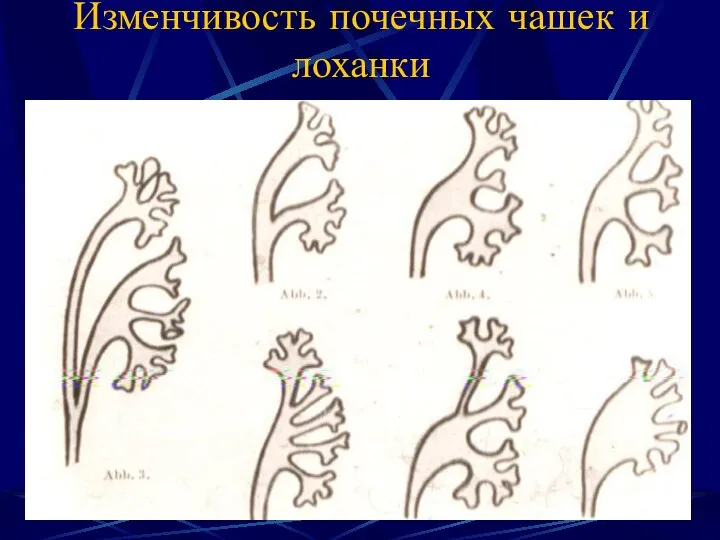 Изменчивость почечных чашек и лоханки