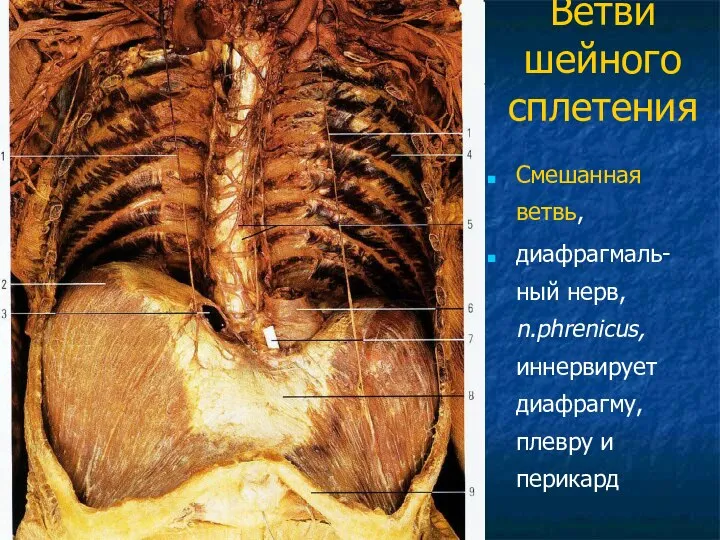 Ветви шейного сплетения Смешанная ветвь, диафрагмаль-ный нерв, n.phrenicus, иннервирует диафрагму, плевру и перикард