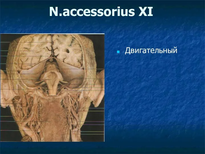 N.accessorius XI Двигательный