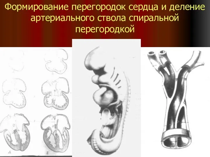 Формирование перегородок сердца и деление артериального ствола спиральной перегородкой