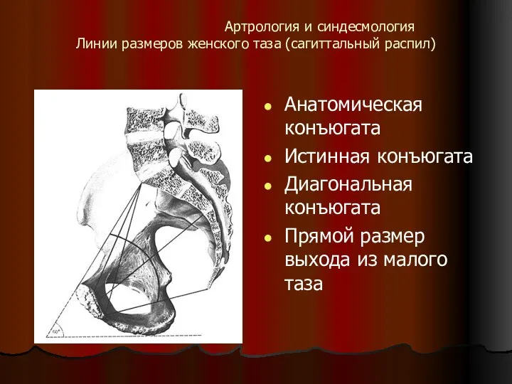 Артрология и синдесмология Линии размеров женского таза (сагиттальный распил) Анатомическая конъюгата