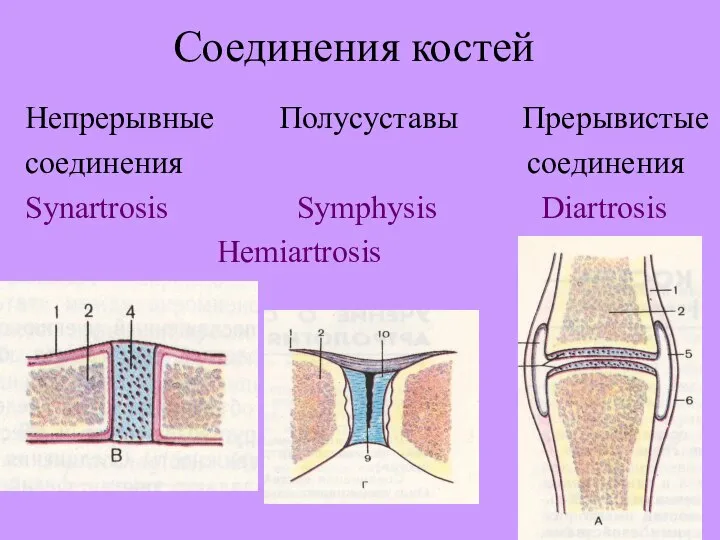 Соединения костей Непрерывные Полусуставы Прерывистые cоединения cоединения Synartrosis Symphysis Diartrosis Hemiartrosis