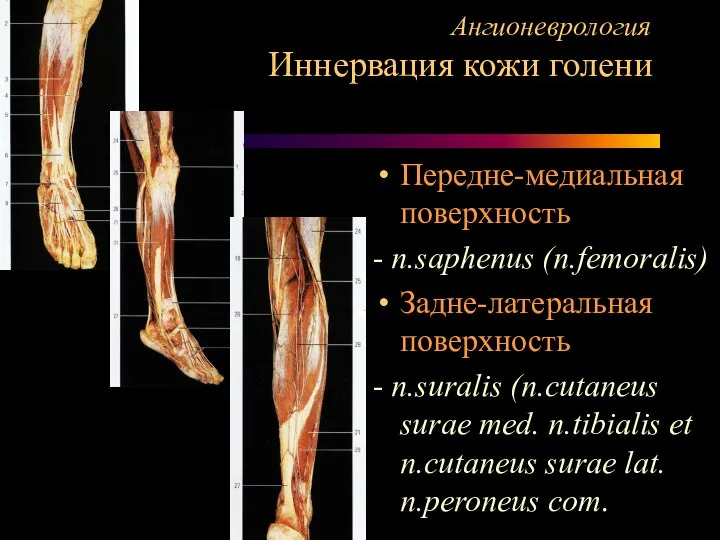 Ангионеврология Иннервация кожи голени Передне-медиальная поверхность - n.saphenus (n.femoralis) Задне-латеральная поверхность