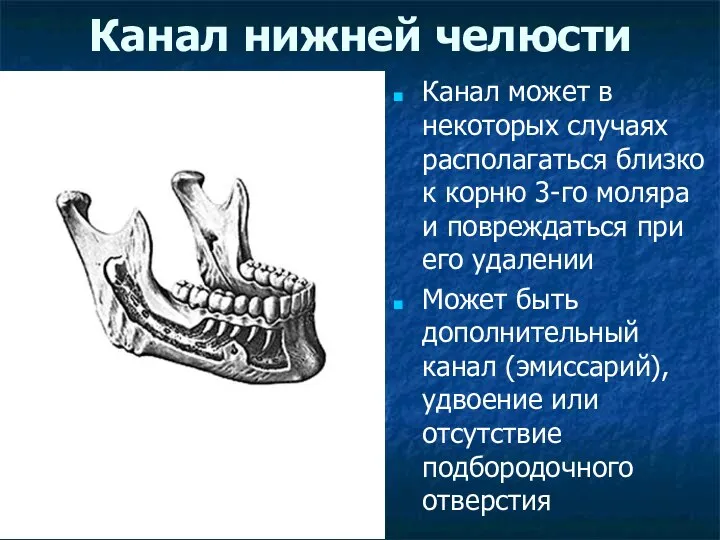 Канал нижней челюсти Канал может в некоторых случаях располагаться близко к