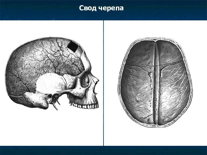 Свод черепа