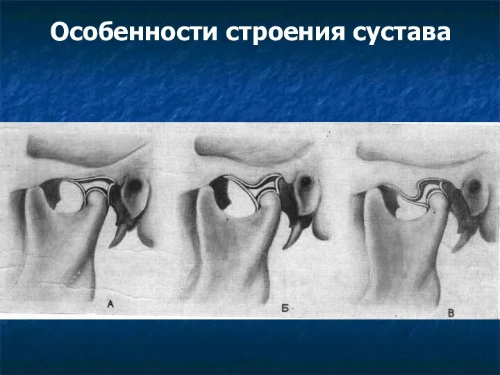 Особенности строения сустава