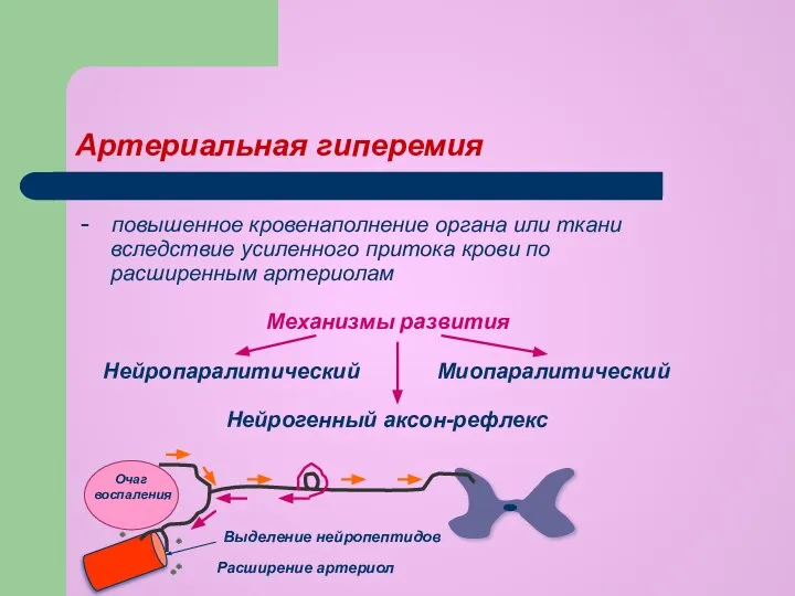 Артериальная гиперемия - повышенное кровенаполнение органа или ткани вследствие усиленного притока