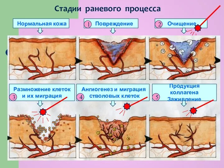 Нормальная кожа Повреждение Очищение Размножение клеток и их миграция Ангиогенез и