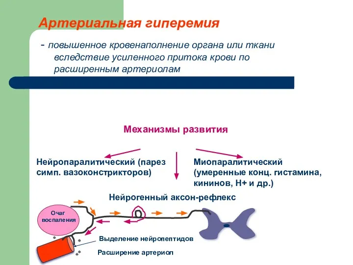 Артериальная гиперемия - повышенное кровенаполнение органа или ткани вследствие усиленного притока